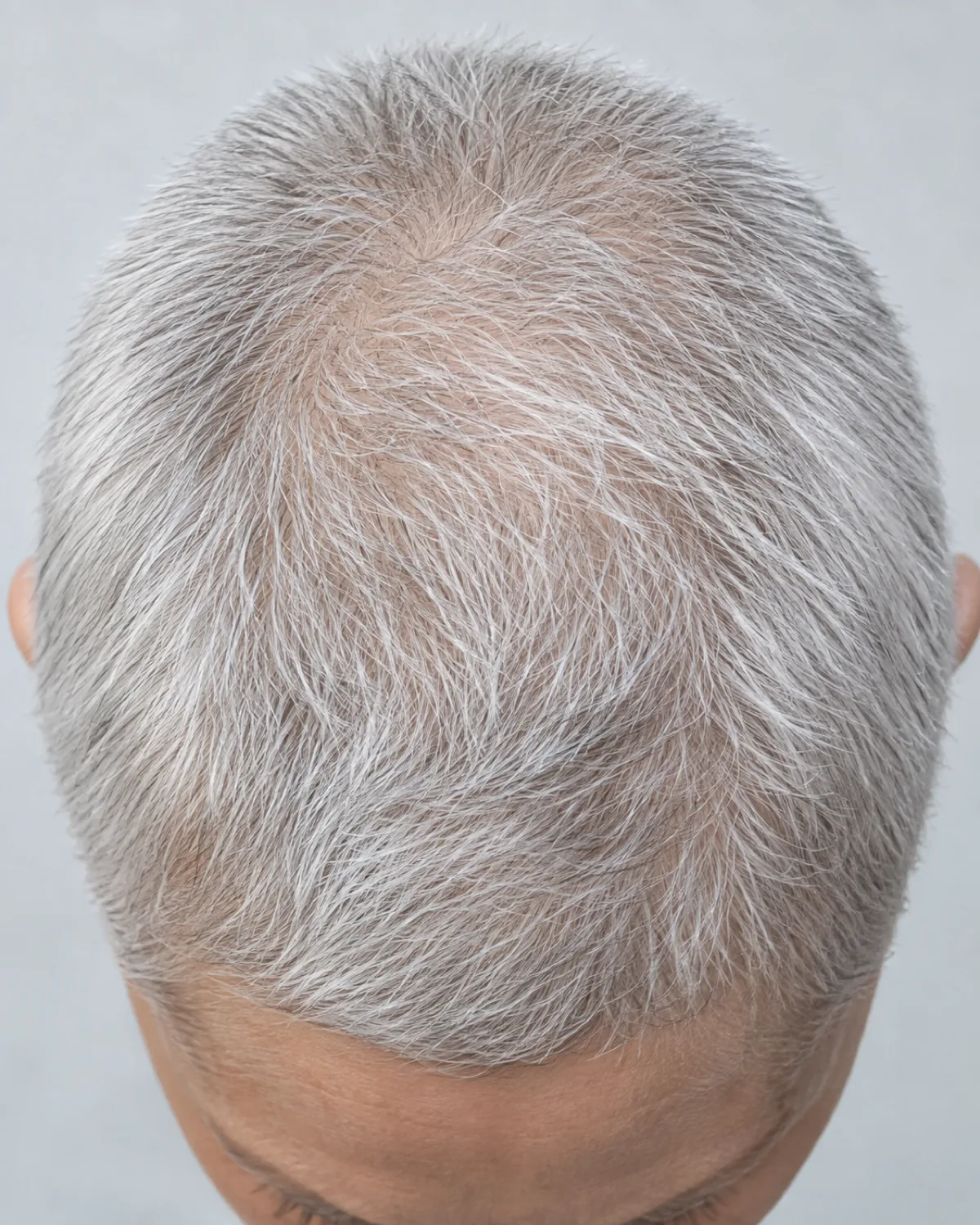 Top-down macro view of a woman's crown with buzz-adjacent crop, silver-white hair at half an inch, skull shape visible